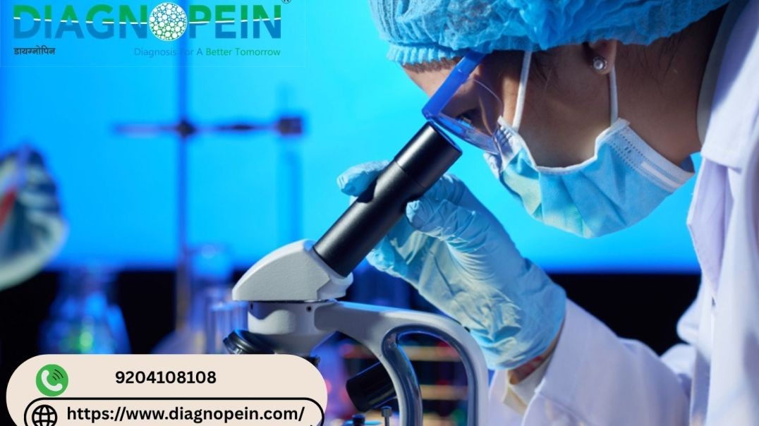 HbA1C Test in Pune | Professional Diagnostic Services in Pune